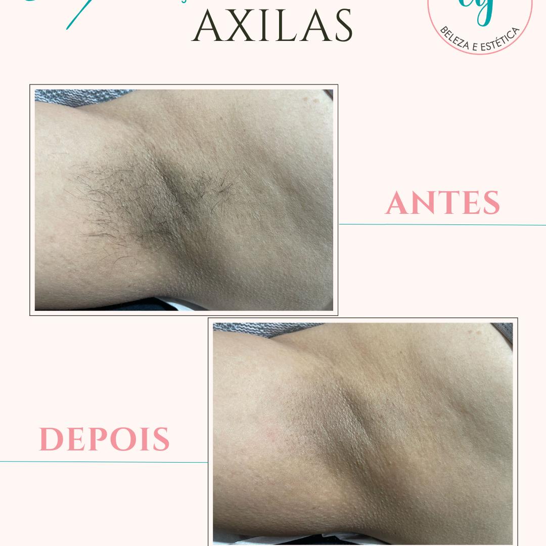 D'Epilação Axilas feminino