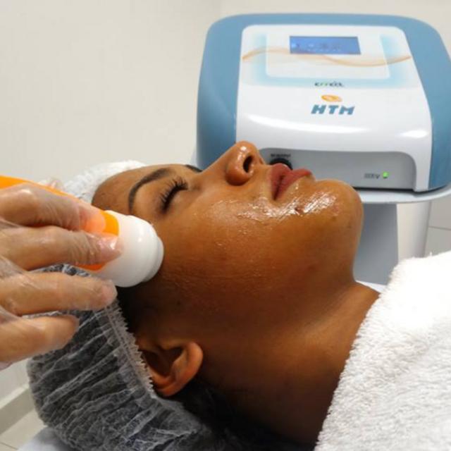 Radiofrequência para flacidez facial