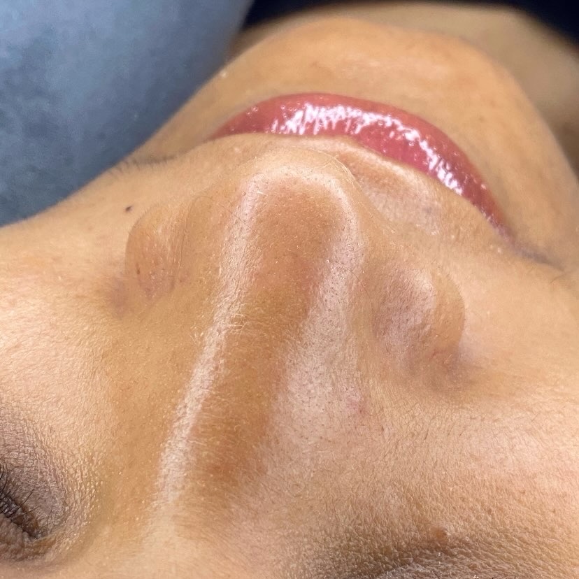 Limpeza de pele