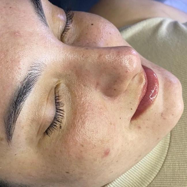 Limpeza de pele