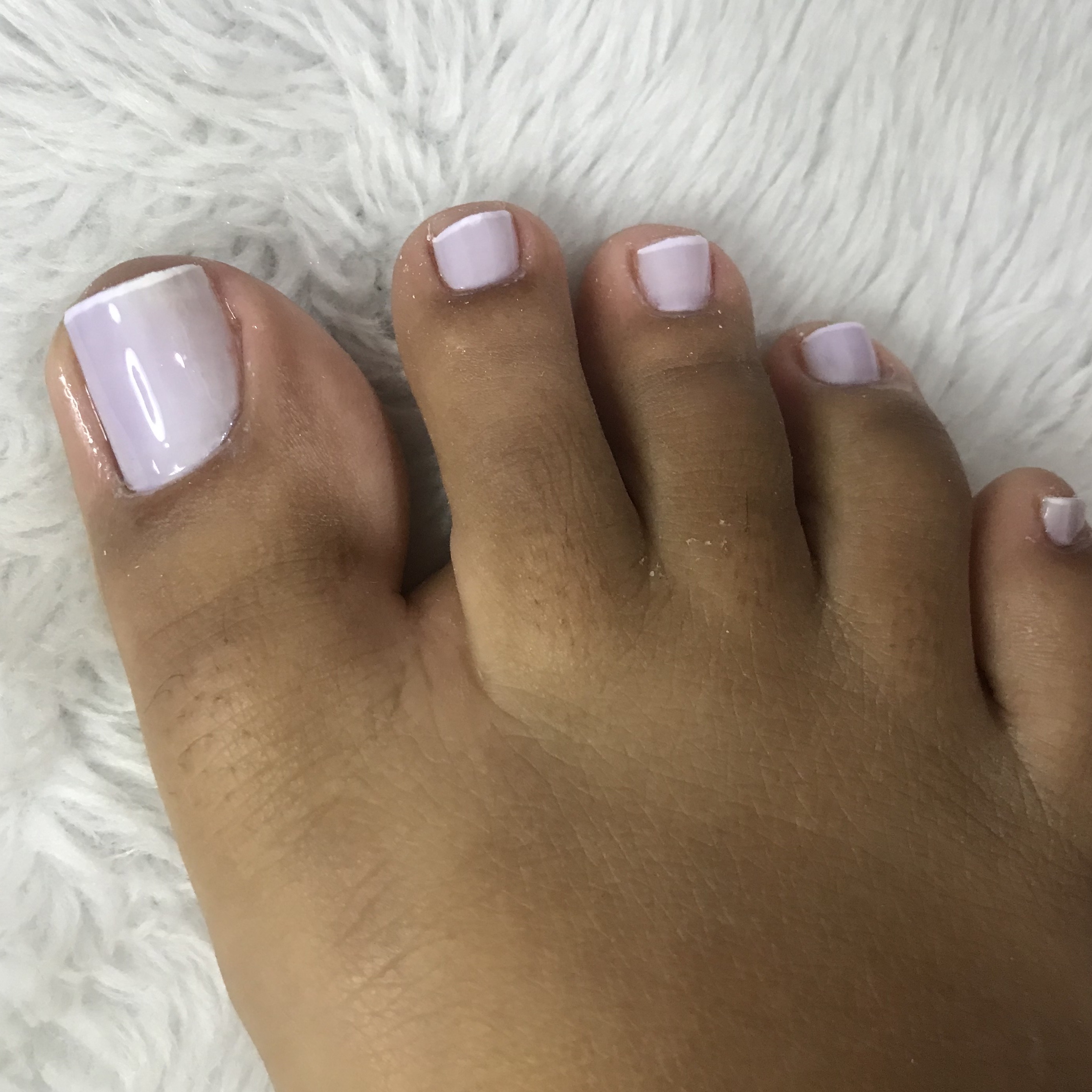 pe