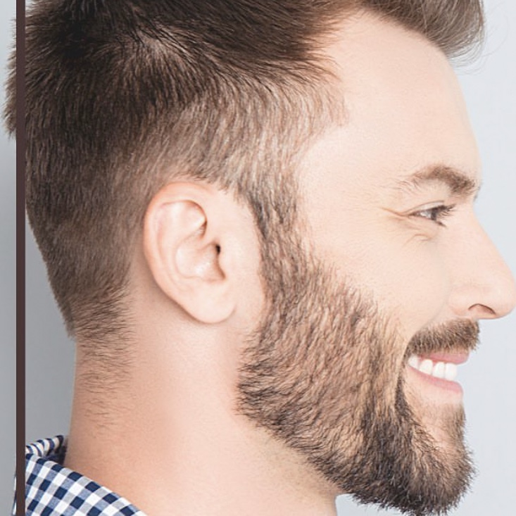 Microagulhamento Barba