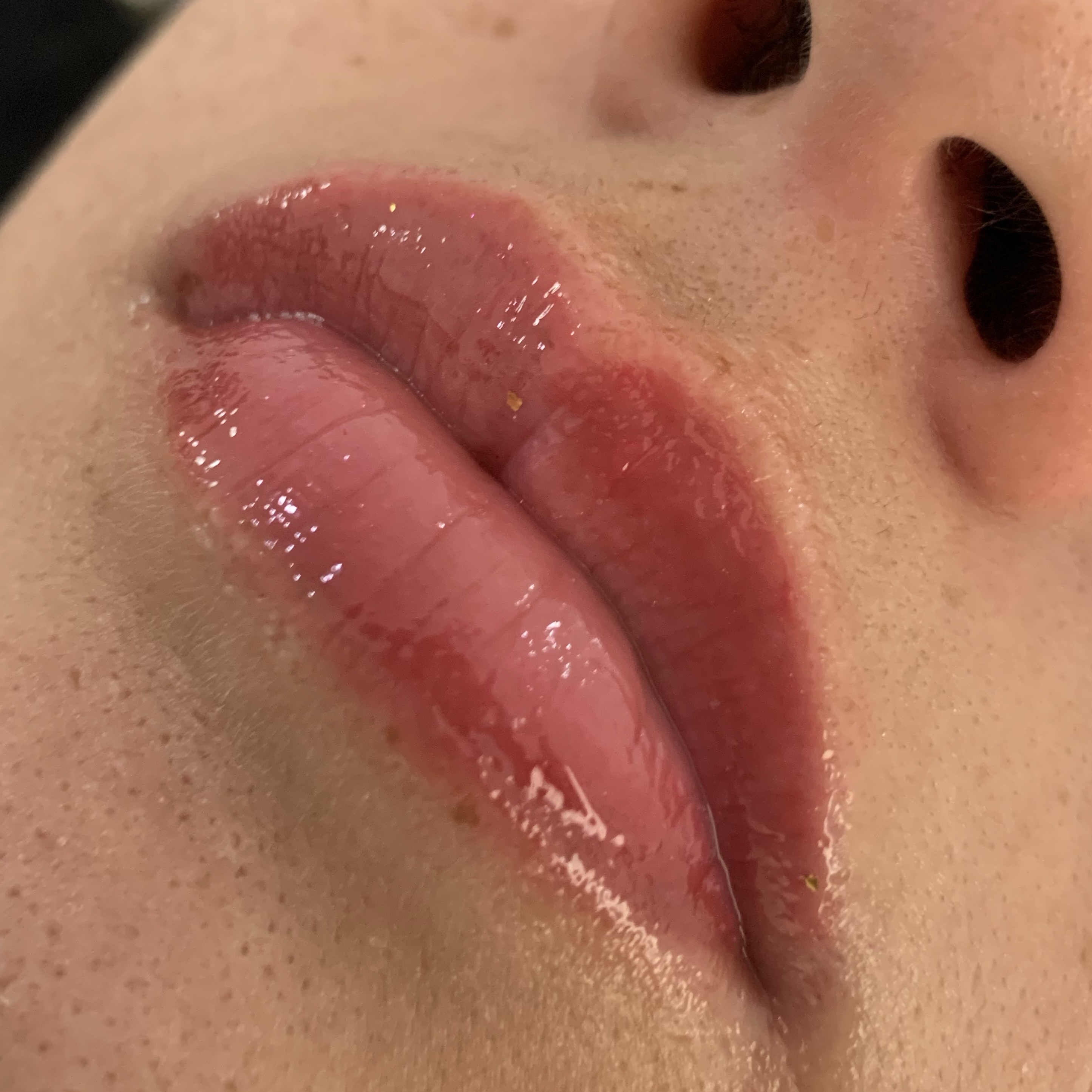 Hidra gloss lips