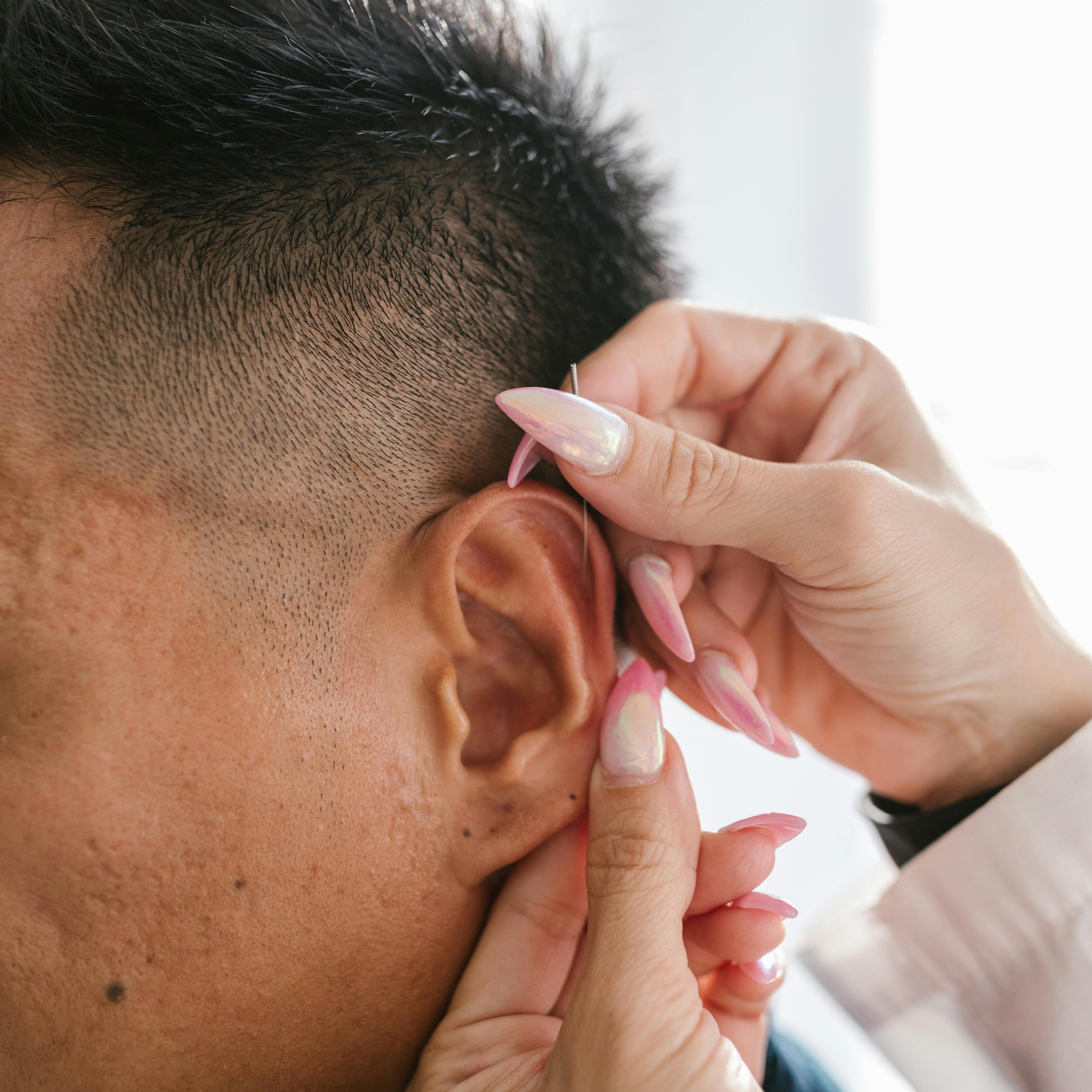 Auriculoterapia Neurofisiológica 20 minutos (agulhas)