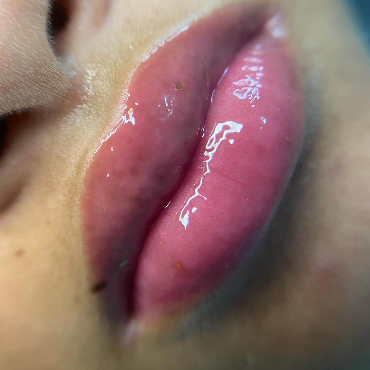 spa labial