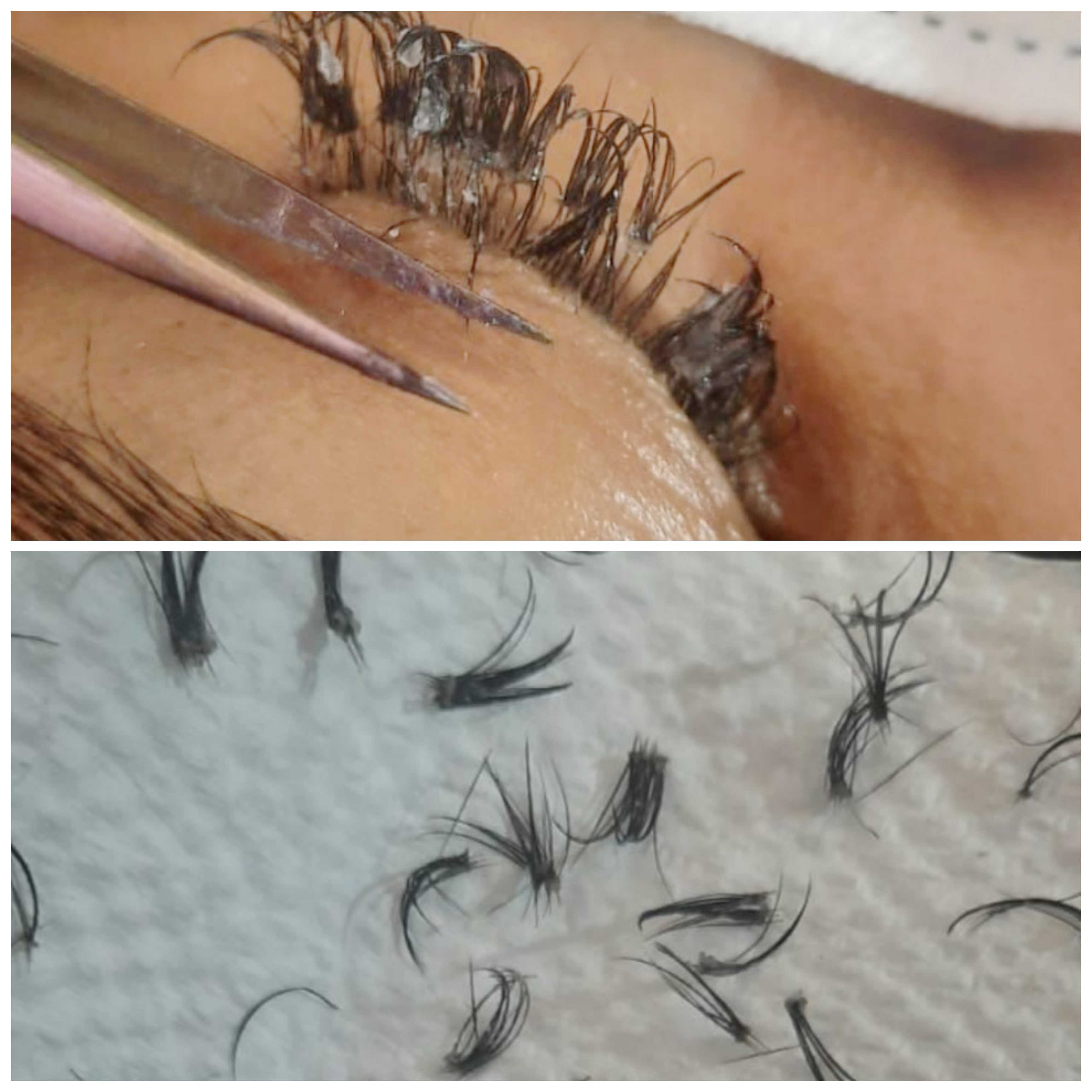 Remoção de outra profissional