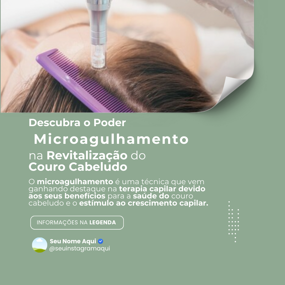 Microagulhamento (Incluso Avaliação)