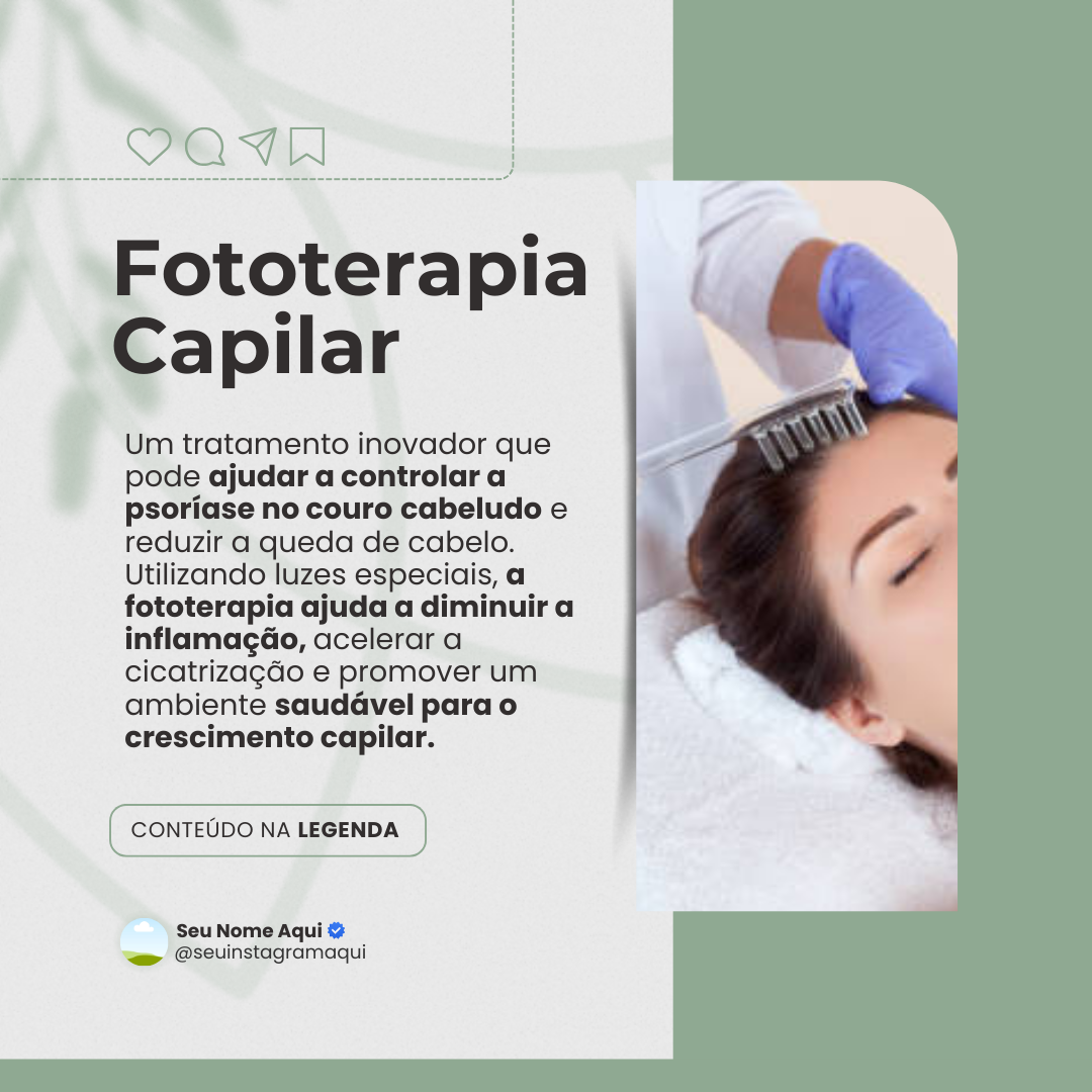 Tratamento para Estímulo do Crescimento Capilar (Indicado para alopecia androgenética e alopecia areata) (10 Sessões)