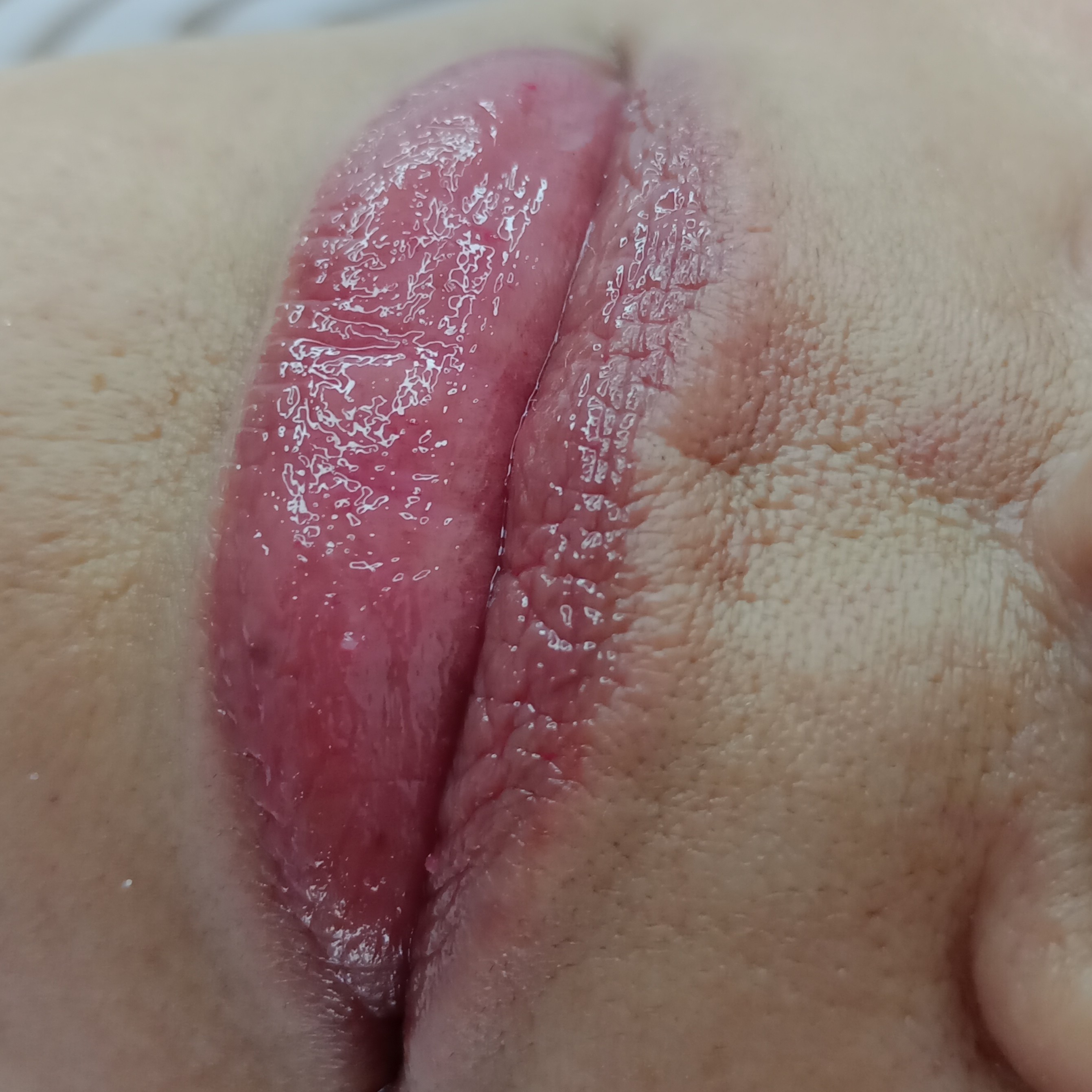 Spa labial