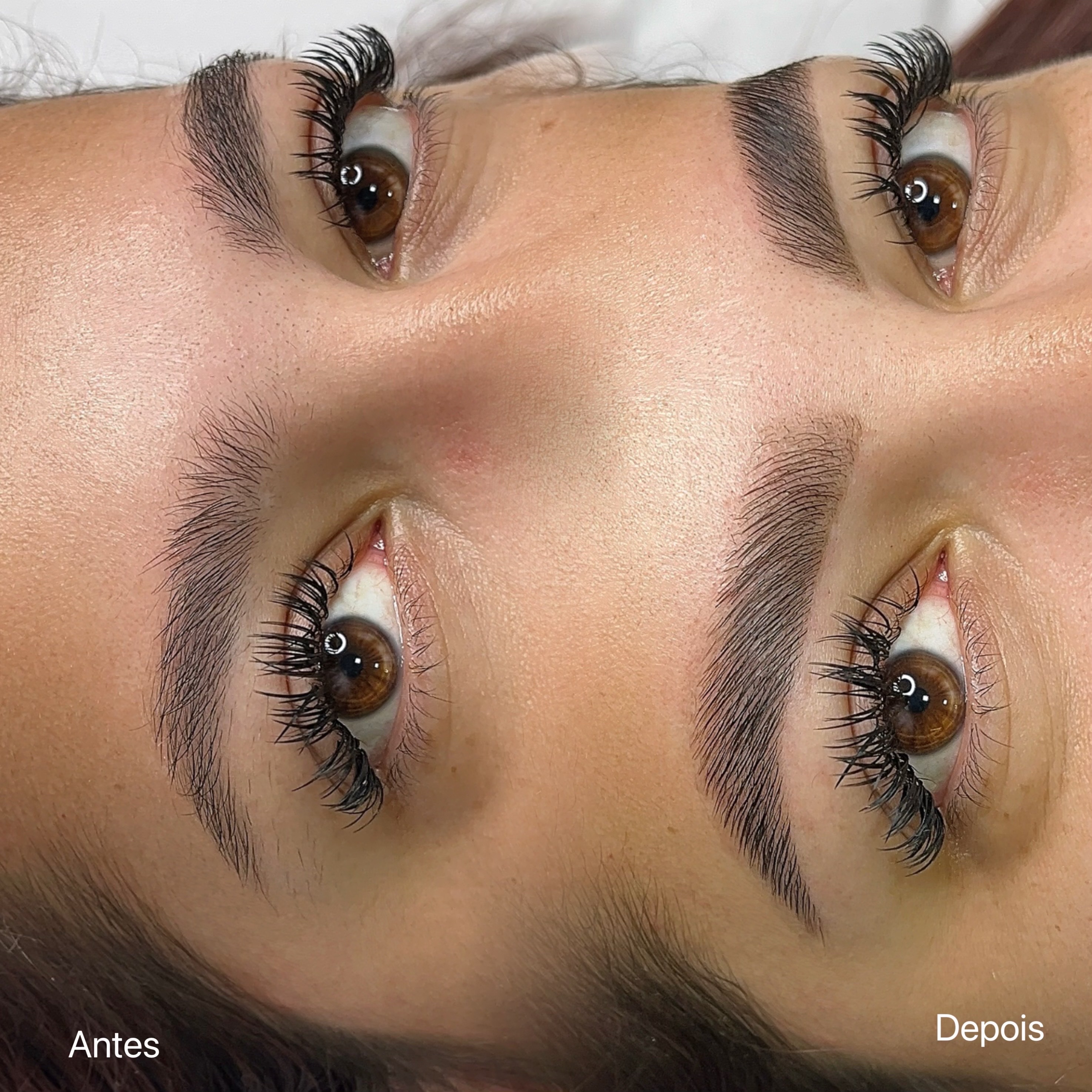 Lift Brows