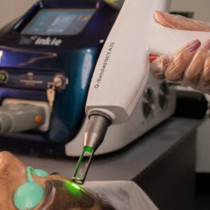3 SESSÕES DE LASERTERAPIA ANTI MELASMA