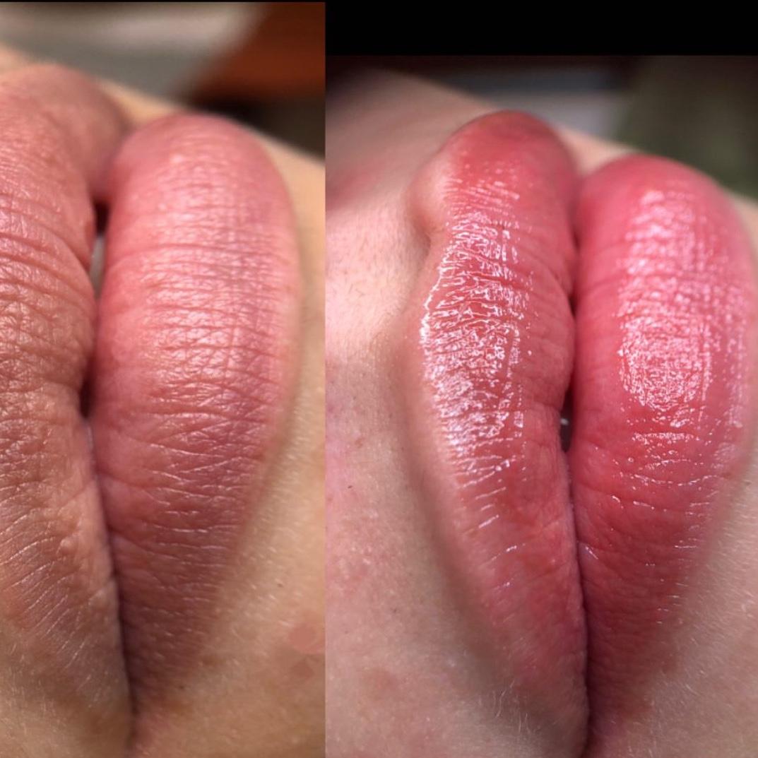 Micro Labial