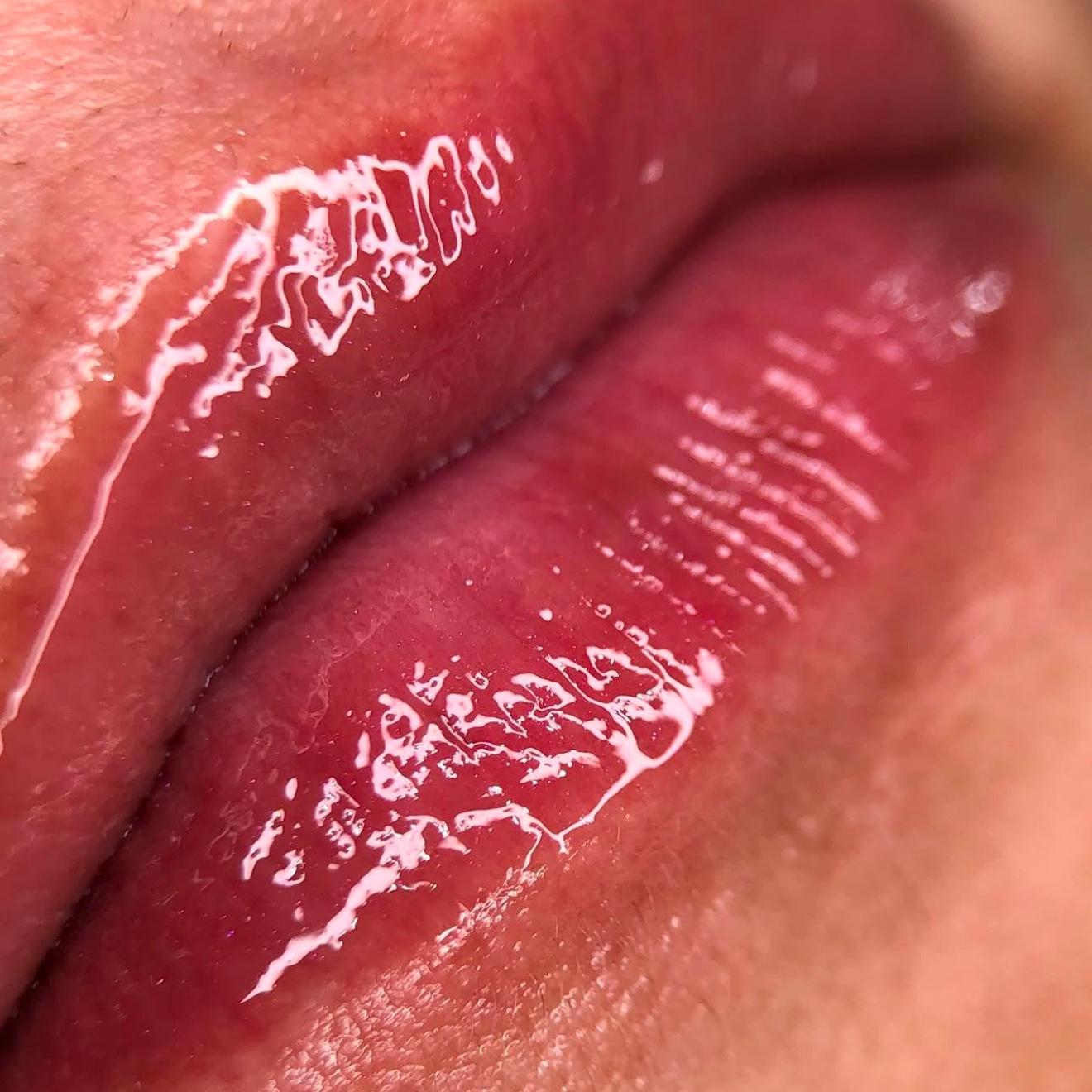 Hidragloss
