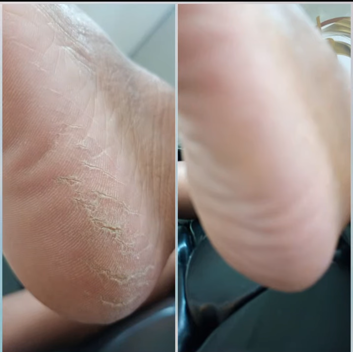 SPA dos pes