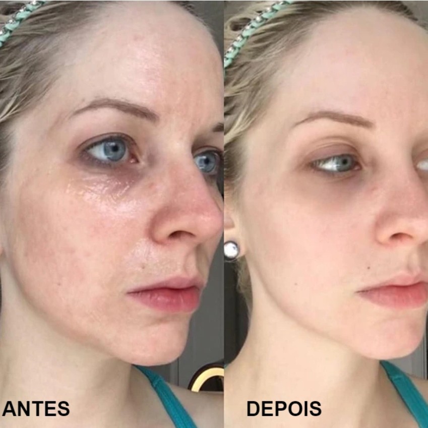 MASCARA PROXY ENZIMATICA: rosto,colo e pescoço (valor adicional)