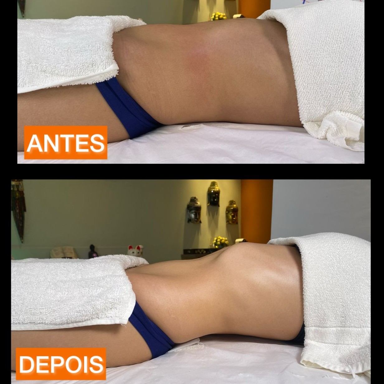DRENAGEM LINFÁTICA: corpo inteiro