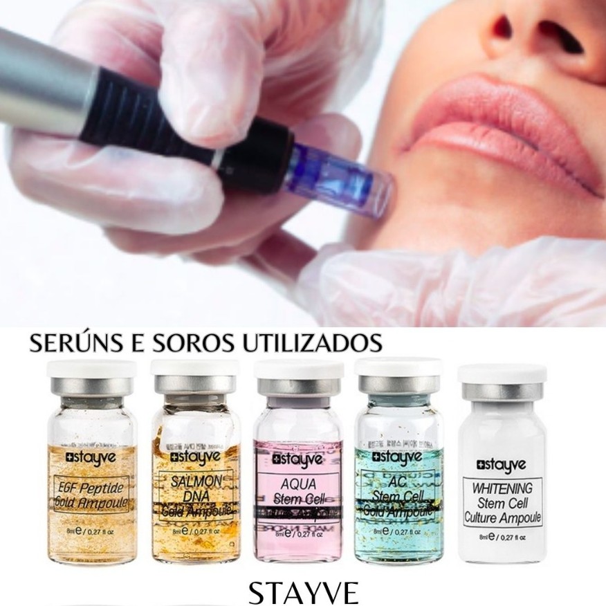 MICROAGULHAMENTO FACIAL
