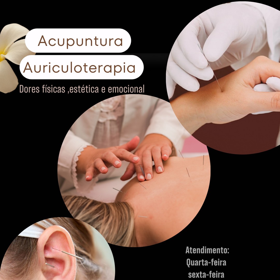 ACUPUNTURA️️️ (pacote de tratamento é personalizado)