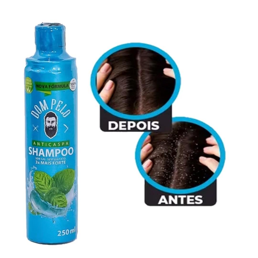 Shampoo anti-caspas cabelo e barba