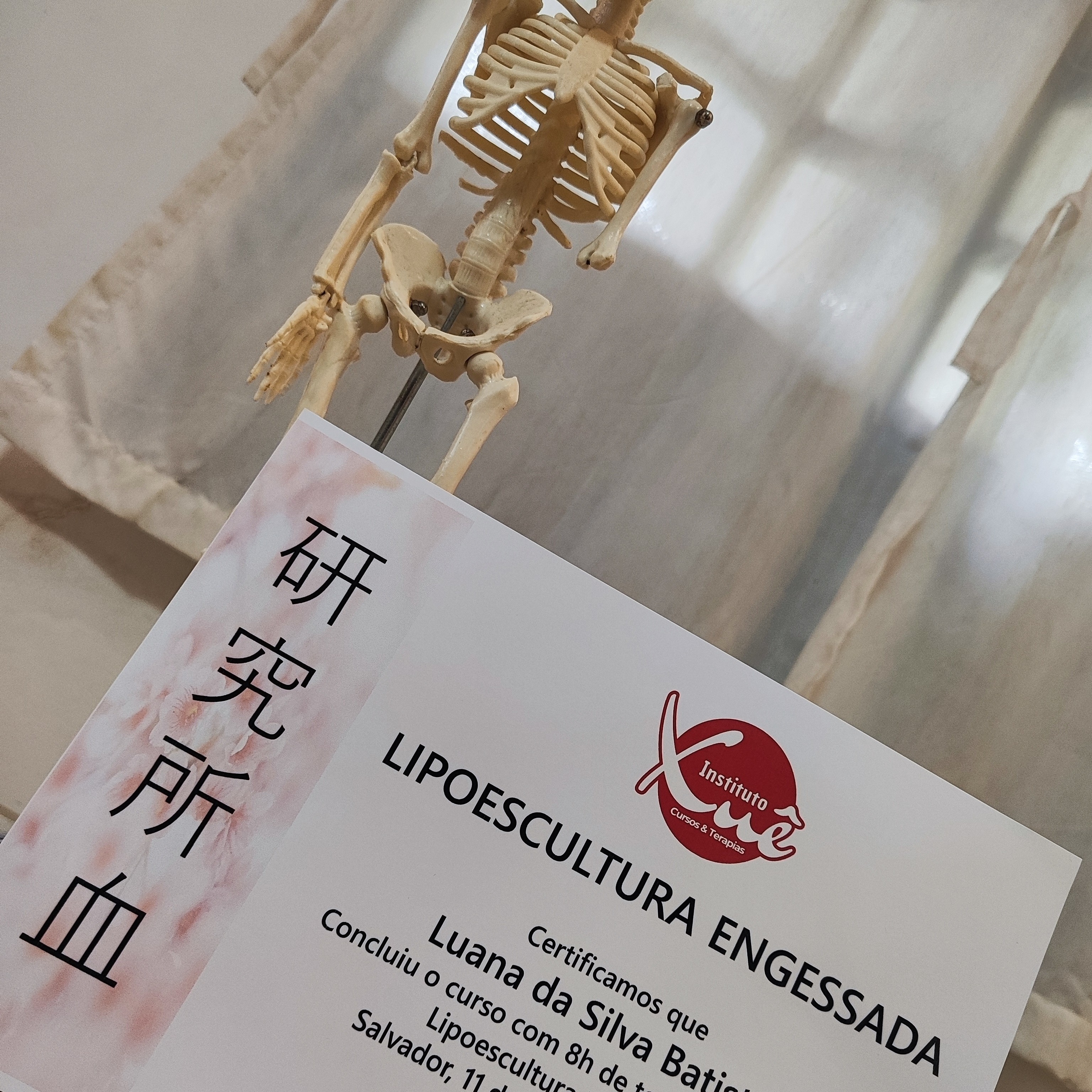 LIPOESCULTURA ENGESSADA