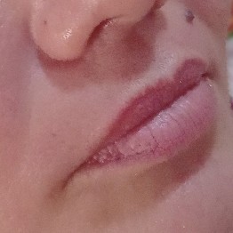 Epilação do Buço