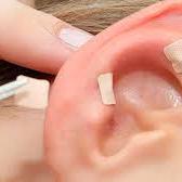 Auriculoterapia - 4 sessões