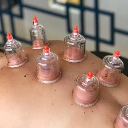 5 Sessões de Ventosa + Massagem + Tens
