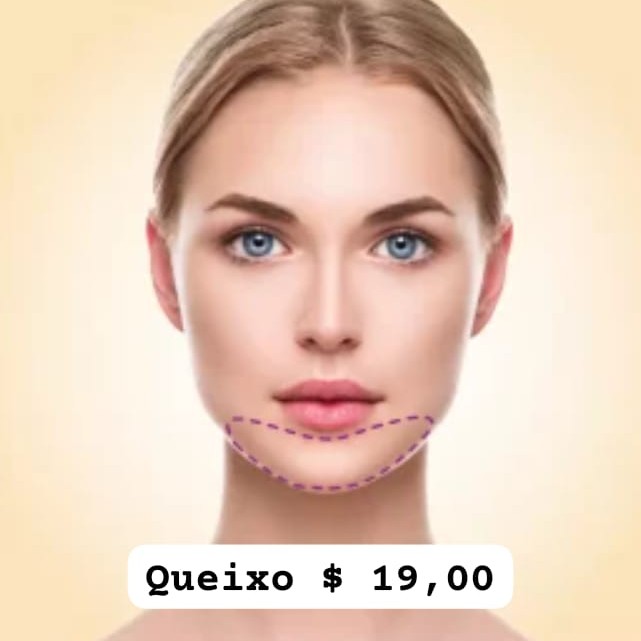 QUEIXO(fazendo mais área sai $10,00)