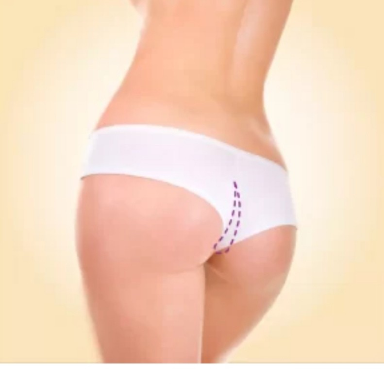 Depilação Anus