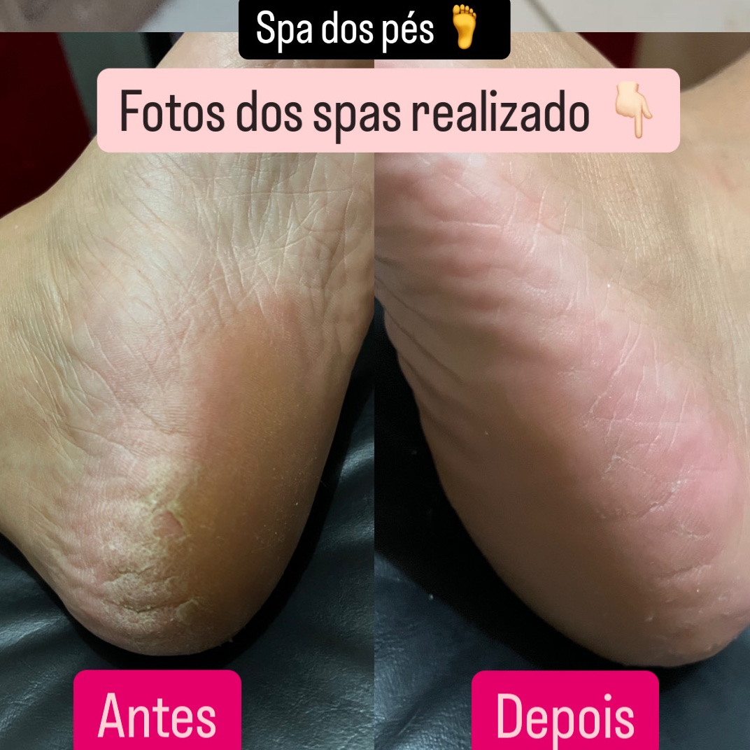 Spa dos Pés
