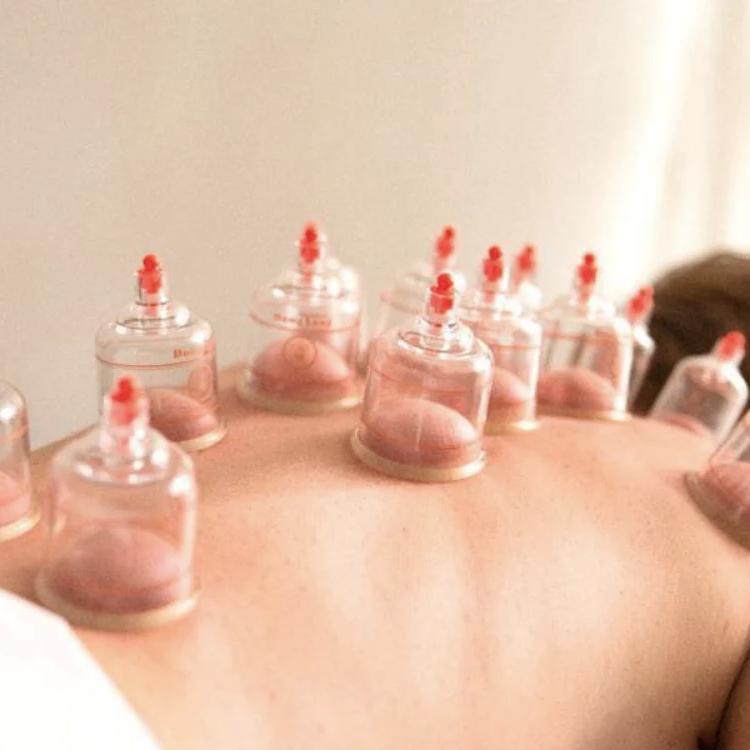 Massagem com Cupping(ventosas) Terapêutico