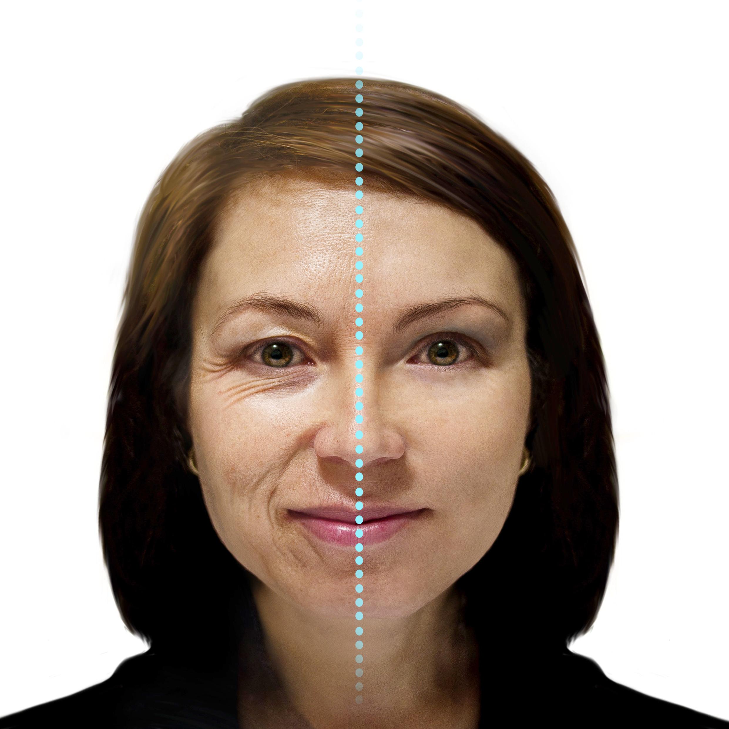 Yoga facial.Botox sem botox. (vídeos inclusos)