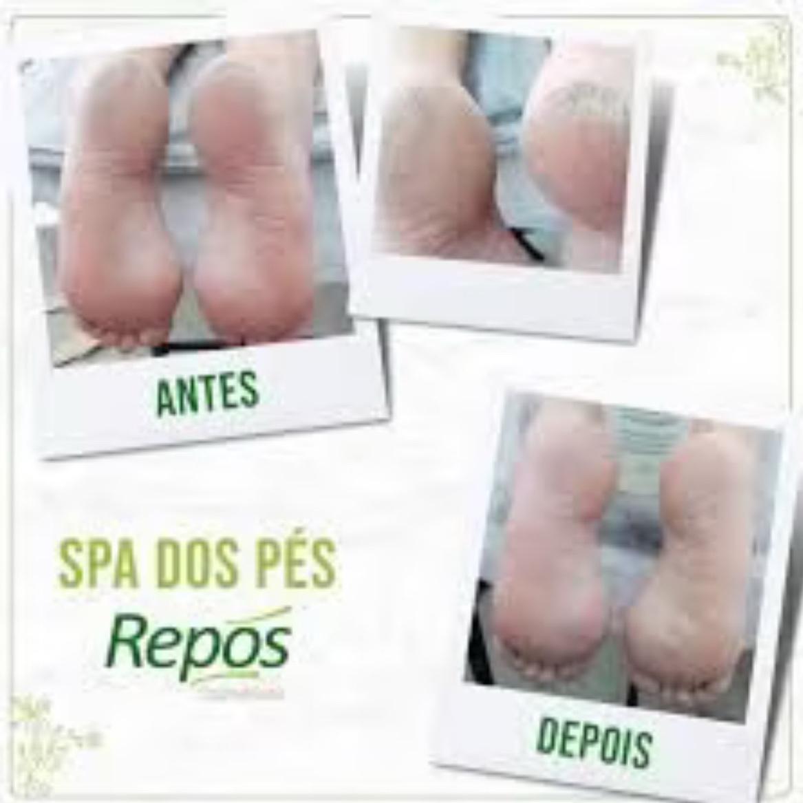 spa dos pés com curtilagem