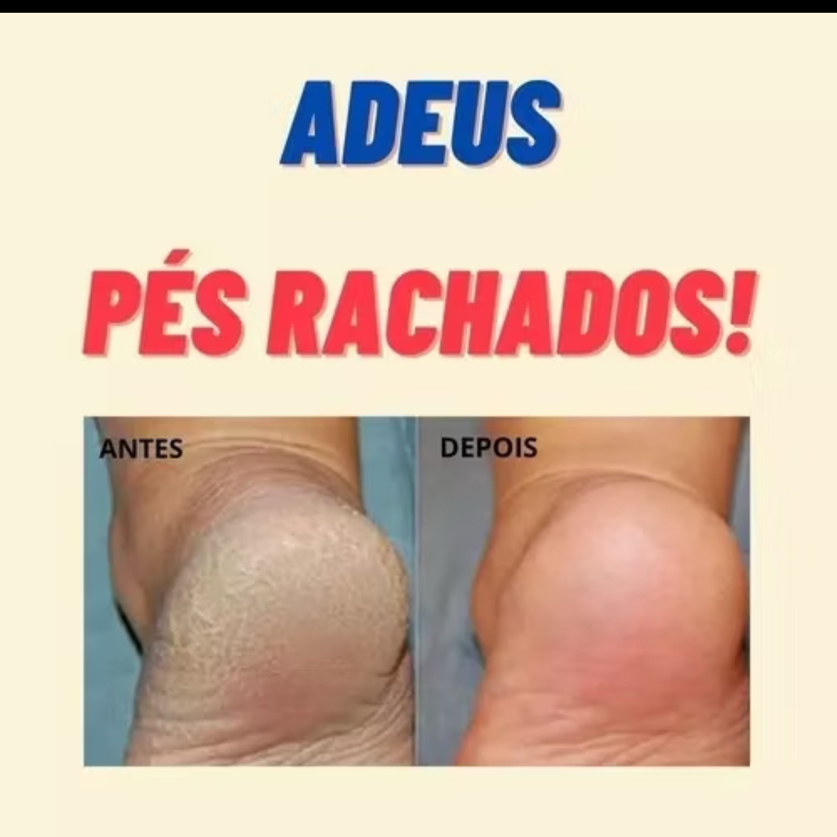 spa dos pés com curtilagem