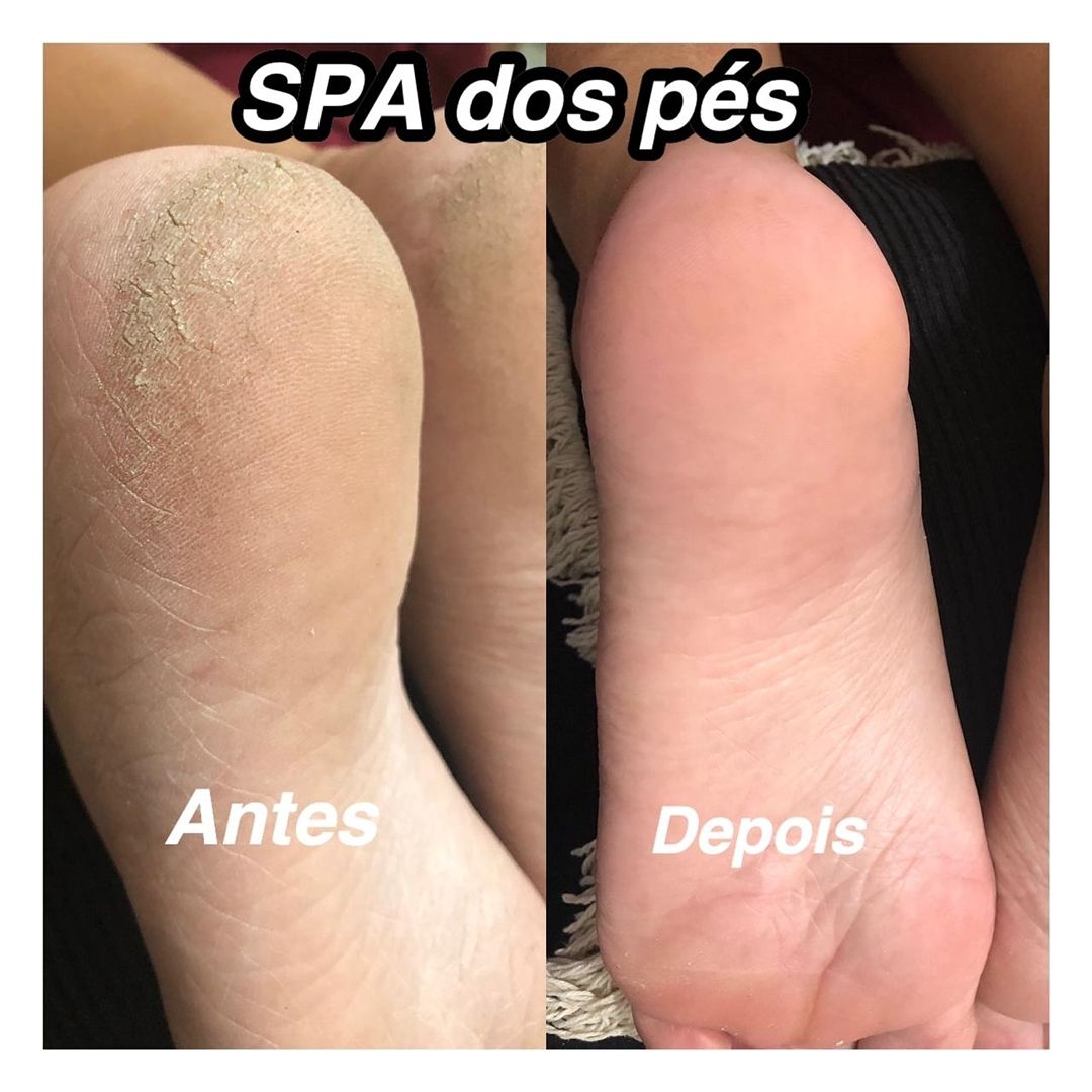 Spa dos pés