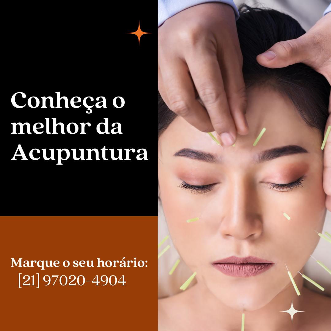 Acupuntura Chinesa