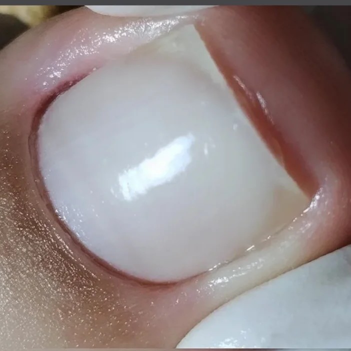 PEDICURE MAIS PODOLOGIA