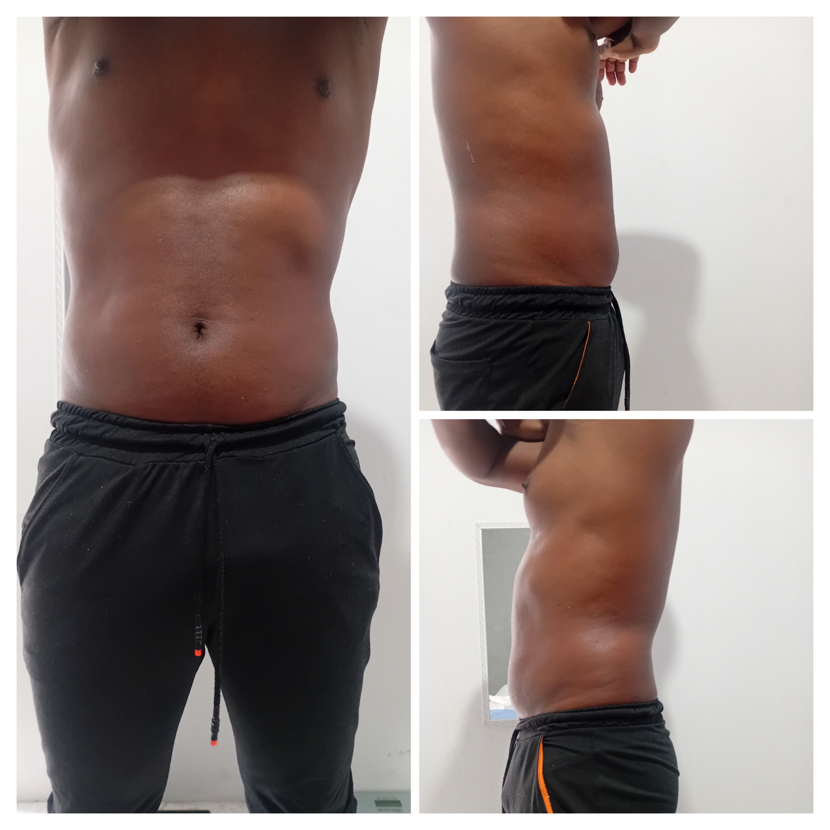 Definição  abdominal