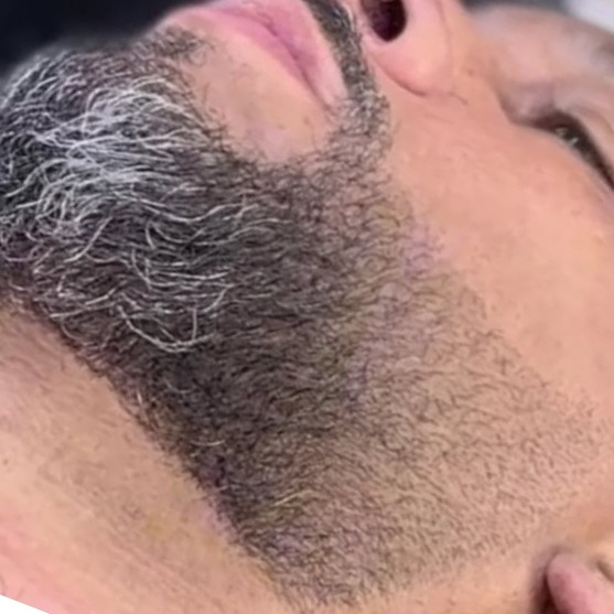 Barba