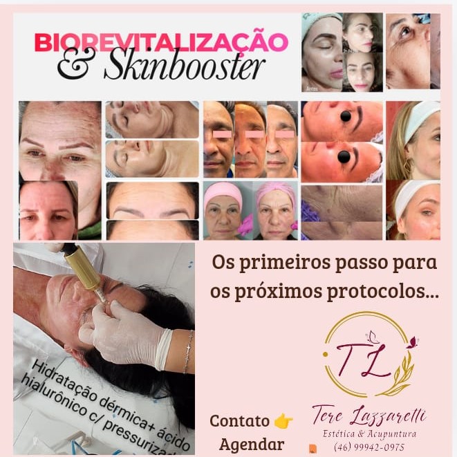SKINBOOSTER COM CANETA PRESSURIZADA