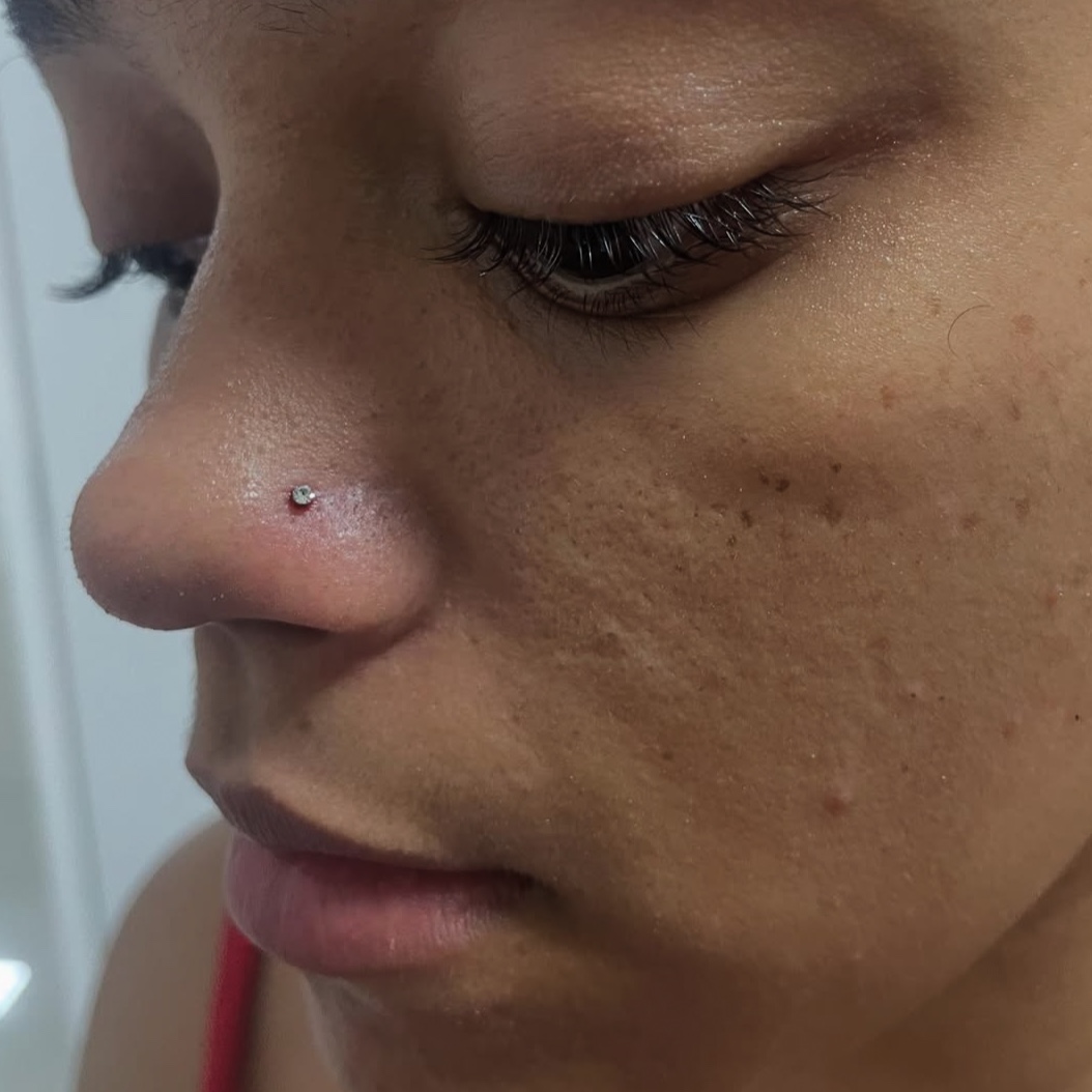 Perfuração simples (joia básica) - Aba nasal