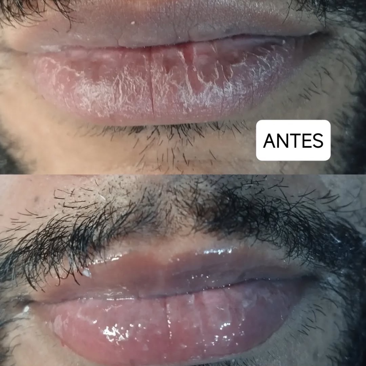 hidragloss