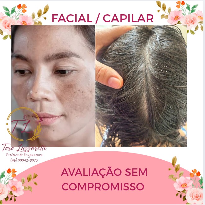 AVALIAÇÃO: FACIAL, CAPILAR,