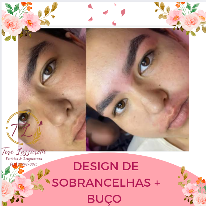 EPILAÇÃO FACIAL + SOBRANCELHAS