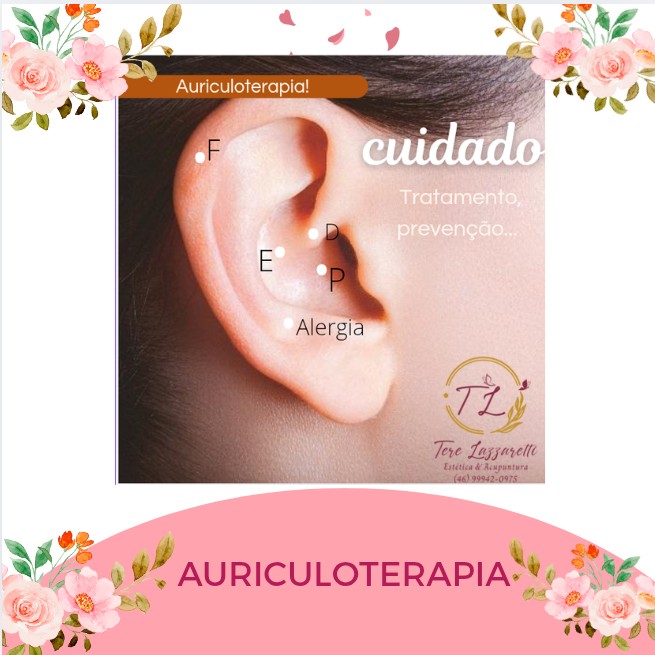 AURICULOTERAPIA TRADICIONAL CHINESA ( SOMENTE EM UMA ORELHA)