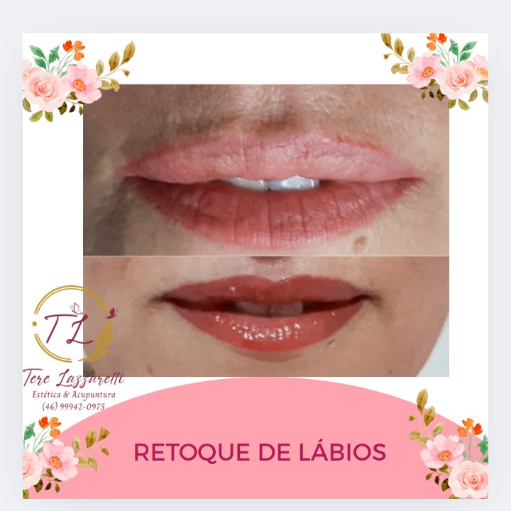 RETOQUE DE LÁBIOS
