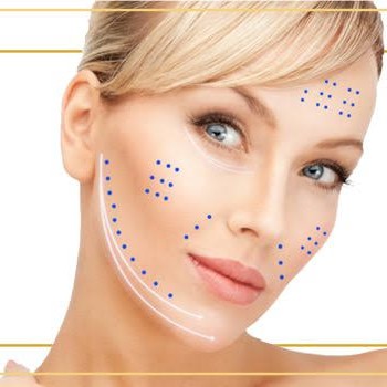 paciente modelo botox
