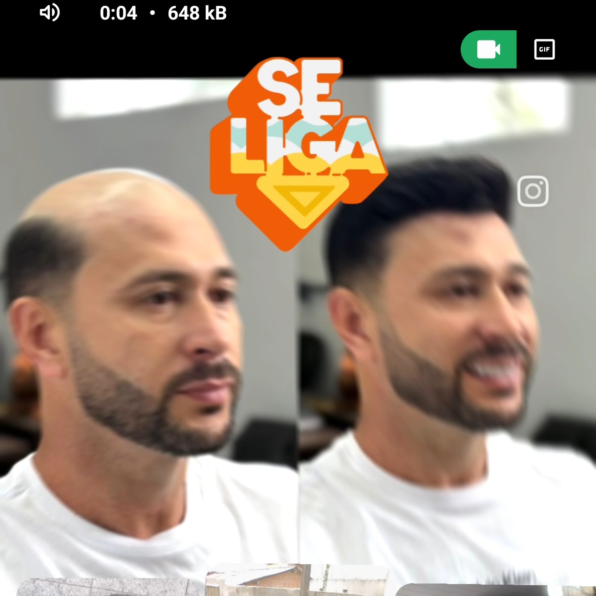 prótese capilar em geral.