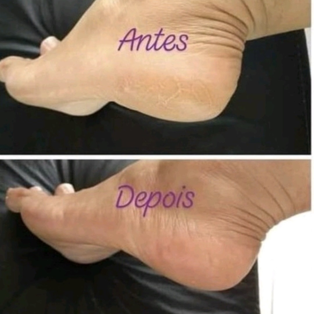 Spar dos pés incluso cutilagem e esmaltação