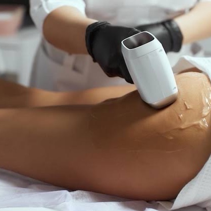 depilação a laser MEIA COXA